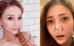 吐槽大会:整容半年后近照首曝光!“太阳花女王”刘乔安变这样