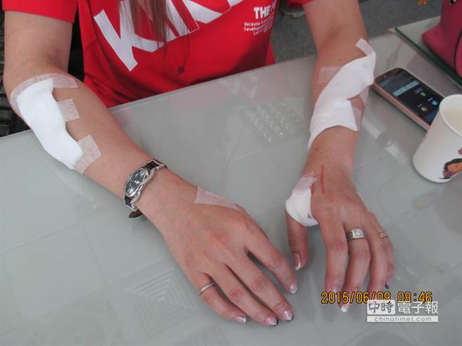 台湾37岁离婚女为博初中同学关心 竟自残谎称遭性侵 台湾37岁离婚女为博初中同学关心 竟自残谎称遭性侵