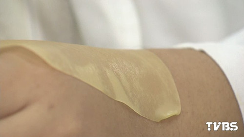 台湾爆炸伤者被烧烫伤“南皮北送”仍不够(图)