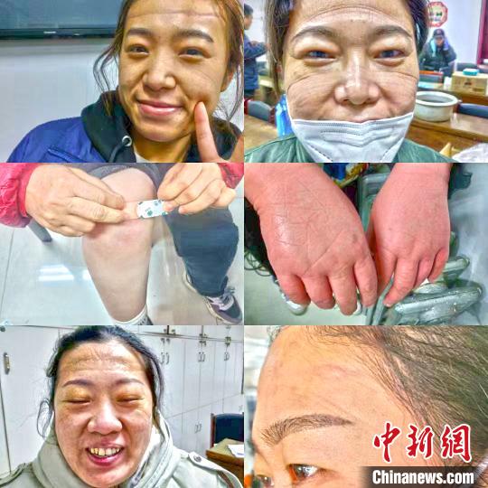 ��������֡�������ͷ������Щҽ����Ա˵����