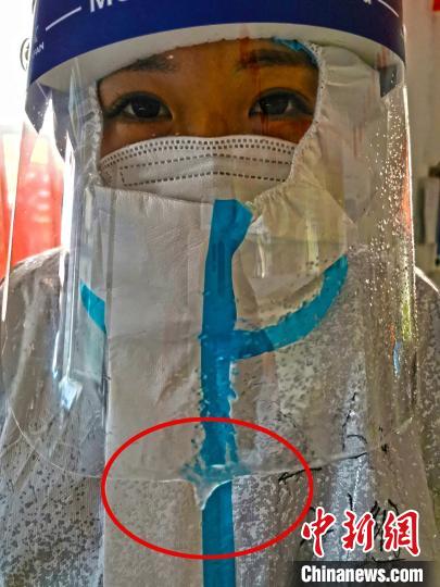 ҽ����Ա��ʱ����������������У���������Ϣ�ڸ��������Ͻ���˱�˪��ͼƬ��½����ҽ��ѧʿ��ѧУ����ҽԺ�ṩ