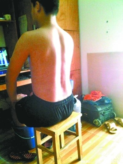 ���ظ����쿹�����̵�