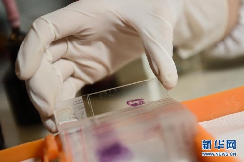 ˶ʿ��Ů���ϵ���ҽ