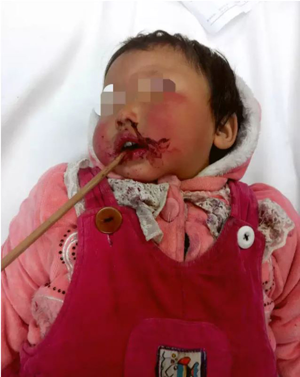 2��27�ա�2��29�գ�����������������С���ÿ��Ӵ��첿����Դ����������͵��Ϻ��»�ҽԺ���Ǻ�ͷ��������ȡ�