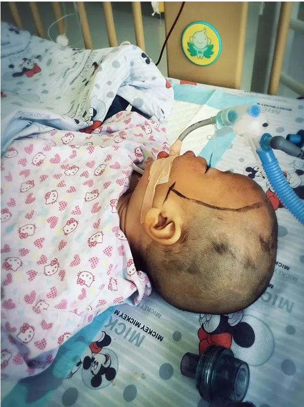 2��29�����磬�ڶ���������ʼ������������Լ1��Сʱ����Ȼ�ο��ӵĹ���ֻ��45�뵽1���ӣ���ҽ���Ƕ��������ң����³���Σ�ա����ң�����һ��˳�����ڿ���˳���γ���ͬʱ��ҽ��Ҳ�ṩ��һϵ�п���ͻ��Ѫ�����ϵĿ���Ⱦ������