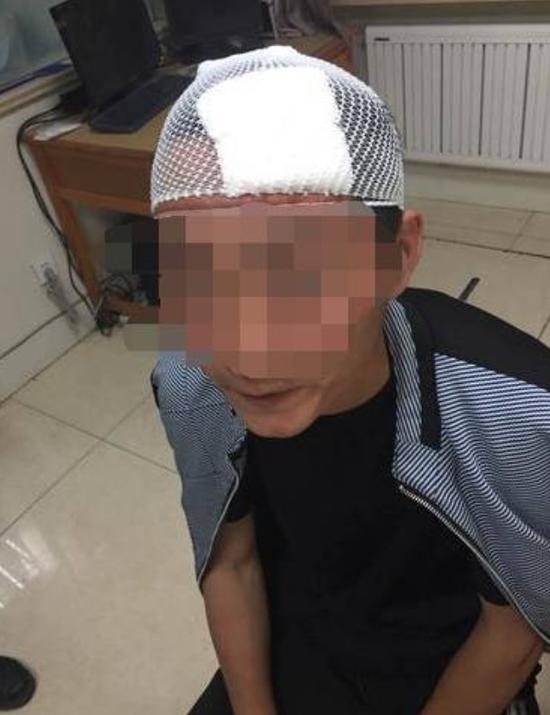 �������񾯣�