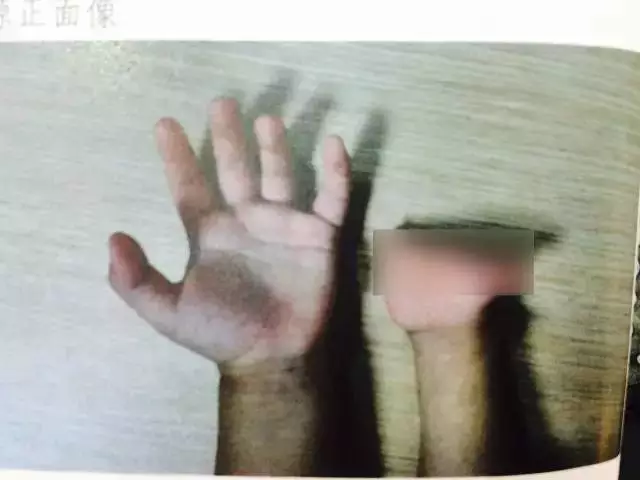 孕妇多次产检仍生下唇腭裂女儿 家属要求医院担责