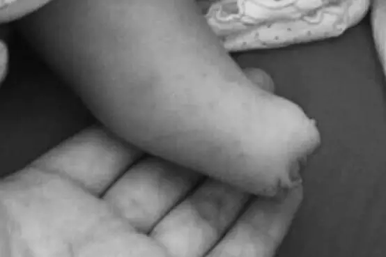 孕妇多次产检仍生下唇腭裂女儿 家属要求医院担责