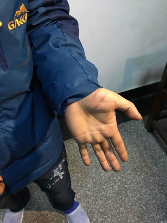  ����6600Ԫû�вʣ���ɽ�������������Ը�5�������Ʊ����١�