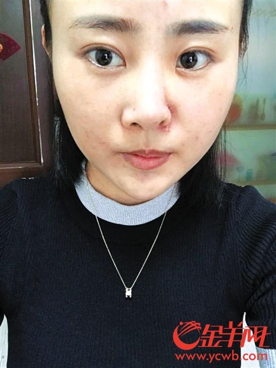 受害人被打前后对比 (图片由当事人提供)