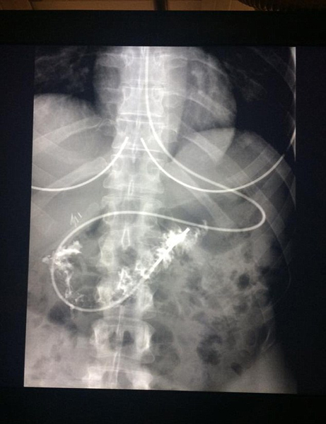 ��Ů�ӻ�������θ��ֻ̱�ܿ����ӽ�ʳ