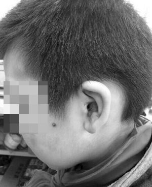 南京遭虐待男童称因撒谎被打不怪继母 南京遭虐待男童称因撒谎被打不怪继母