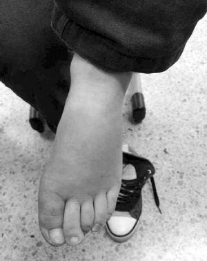 南京遭虐待男童称因撒谎被打不怪继母 南京遭虐待男童称因撒谎被打不怪继母