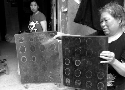 ־ĸŵ־ͷ˵CTƬӡʱ ֣