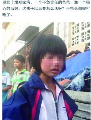 ������ʮ��7��Ůͯ��Ű�����¼�������֮���������㷺��ע�����ߴӺ���ʡʮ���й����ֻ�Ϥ����Ű��Ůͯ�ĸ�����ĳ12����������������������5�ա���ĳ���Լ��ֱ��������ӵķ�����к�ڣ���ʾ�Ժ�����ٴ򡣱���Ůͯ���龭��ҽ��������Ϊ��΢�ˣ�12�������ѷ�У�ϿΡ�