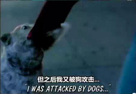 Ů�ӱ�׽��󵭶��糣 ϸ����׽��������