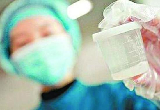 Ů�����Ե׾辫Ⱥ �辫�˳ƿ�ֱ�ӷ����Թ�ϵ