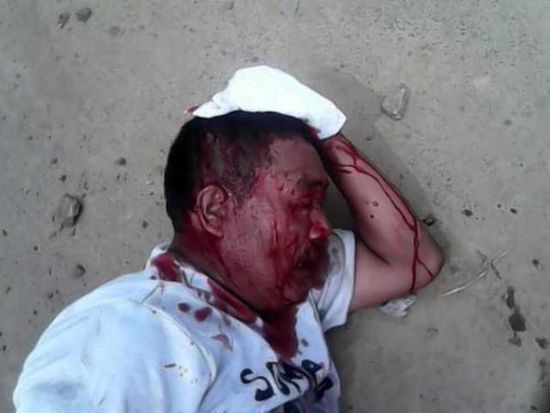 山东村支书与村民两方百人械斗 警方:因土地问题