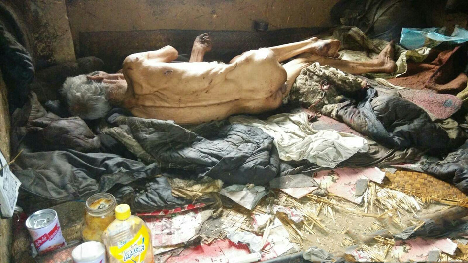 山东平度一孤寡老人无人照顾 被饿到皮包骨(组图) 山东平度一孤寡老人无人照顾 被饿到皮包骨(组图)