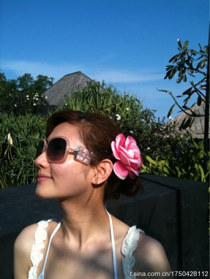 Selina确认为三度烧伤欲回台接受植皮手术(图)