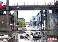 Selina拍戏三度烧伤需植皮加护病房无菌室观察