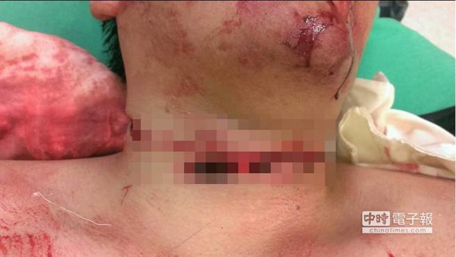 男子城隍庙前砍情敌,前女友30余刀 而后自刎(图)