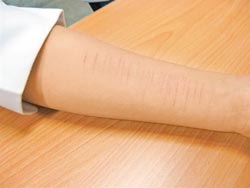 台湾一初中有9名学生曾割腕自残 最多划22刀(图)