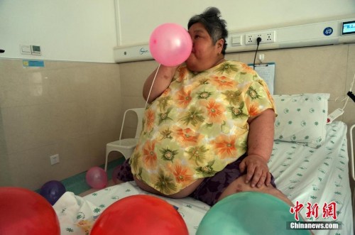 河南350斤重胖姐欲切胃治胖
