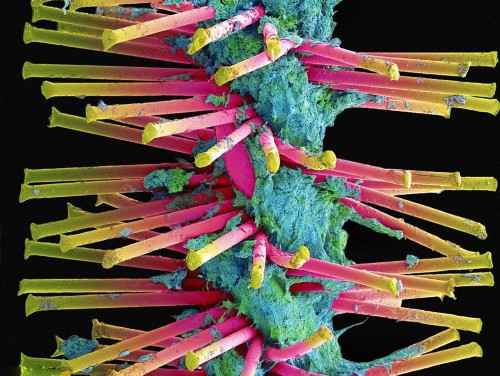 实拍电子显微镜下毛骨悚然的牙齿细菌