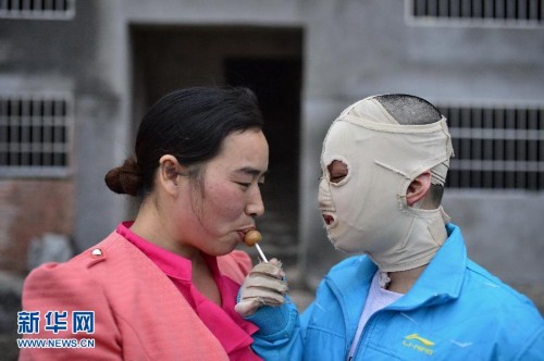 江西面具男孩手术在即费用成难题高清组图