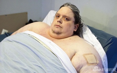 888斤全球最胖男10年未出家门组图