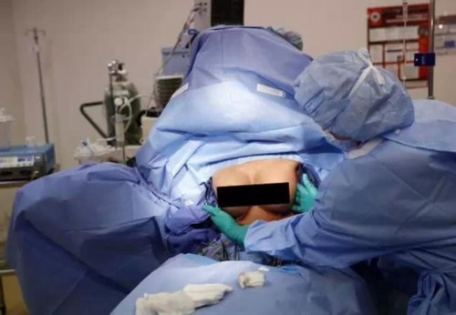 实拍女子丰胸手术全过程