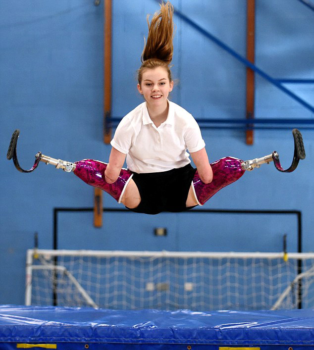 尼日利亚天生无四肢女孩圣诞节去世